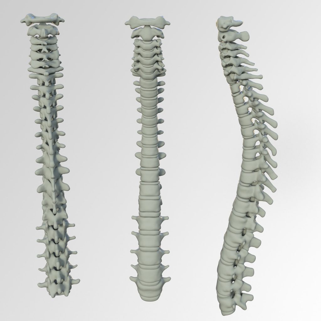 lumbar disk spinal chord